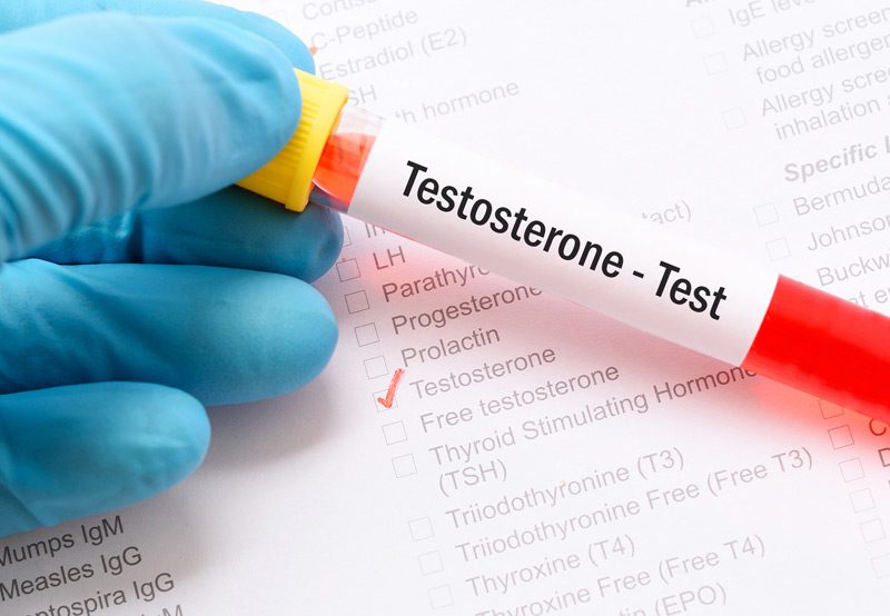 Patient's-blood-sample-for-testosterone-hormone-test