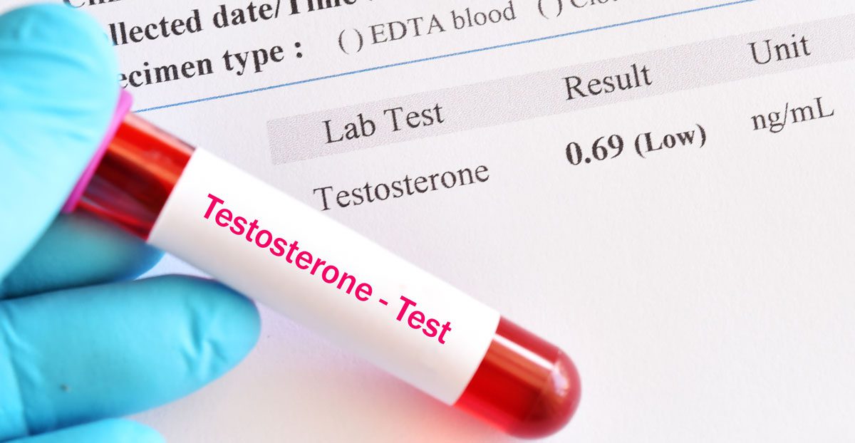 Abnormal-low-testosterone-hormone-test-result