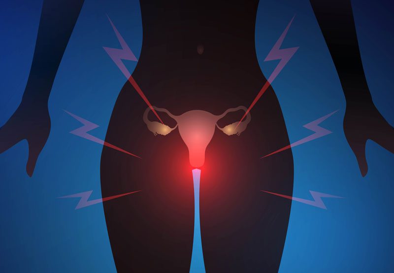 Medical-concept-of-female-urological-issues-and-discomfort