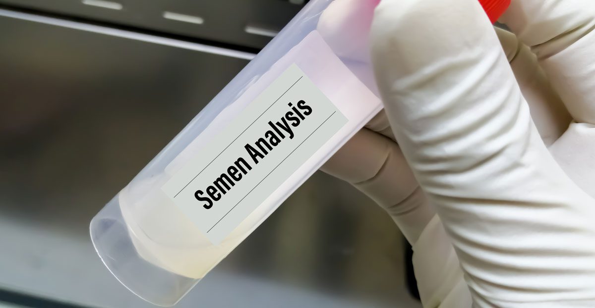 Semen-in-a-pot-for-analysis