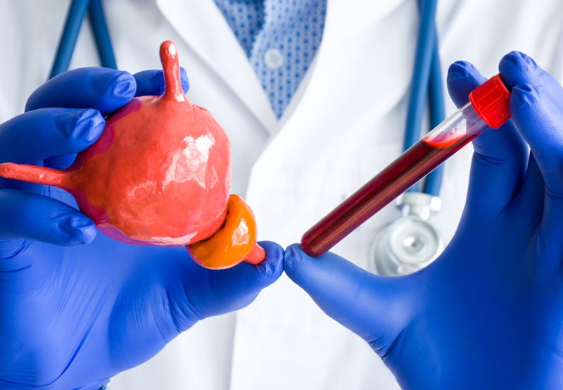 Tests-and-hormones-for-bladder-and-prostate